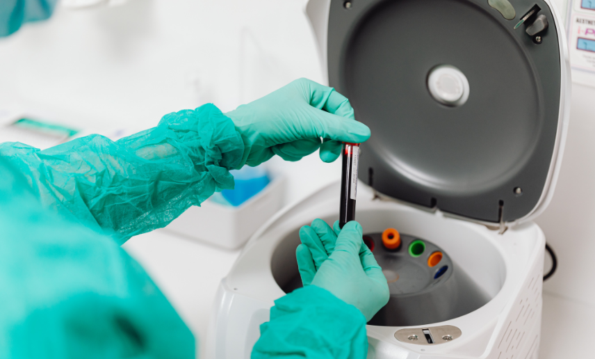 Tips for Accurate Specimen Collection in Hospitals